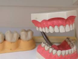 what are permanent dentures family
