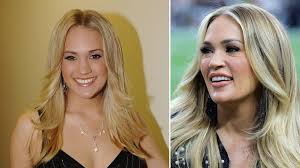 carrie underwood plastic surgery what