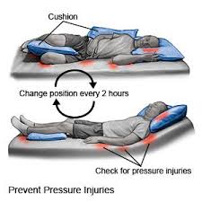 pressure injury discharge care