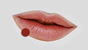 what causes dark spots on lips