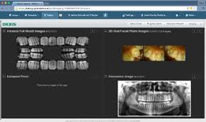 Dentrix Ascend Software Dental Software Free Demo