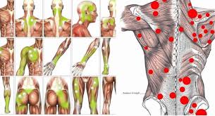 trigger points therapy causes