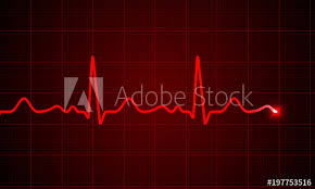 Heart Cardiogram Pulse Chart On Electrocardiogram Monitor