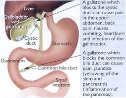 crgh gastroenterology and liver services