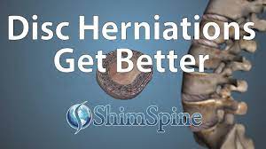 disc herniations or slipped discs get