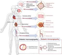 diabetic vascular diseases molecular