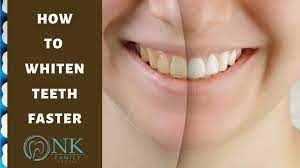 how to whiten teeth faster nk family