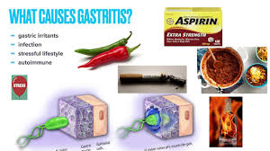 chronic gastritis causes symptoms
