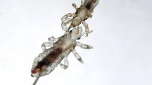 head lice images browse 3 923 stock
