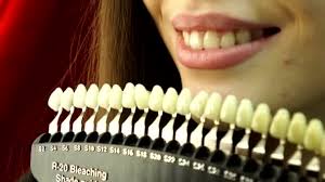Close Up Patient And Tooth Color Chart Young Woman Smiling Effective Teeth Whitening
