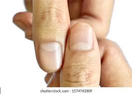 Lunula of nail Images, Stock Photos & Vectors | Shutterstock