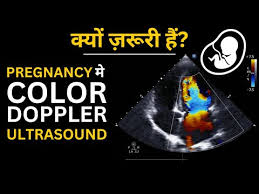 color doppler ultrasound in pregnancy