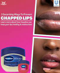 3 surprising ways to prevent chapped lips