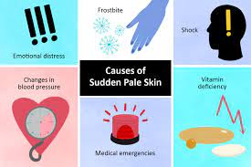 skin paleness pallor causes