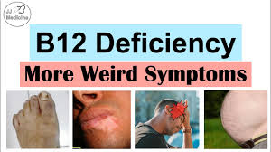 vitamin b12 deficiency weird symptoms