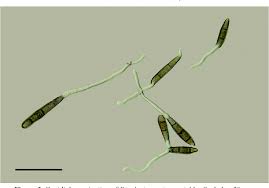 Cabi bioscience genetic resource collection. Fungi On Dragon Fruit In Loei Province Thailand And The Ability Of Bipolaris Cactivora To Cause Post Harvest Fruit Rot Semantic Scholar