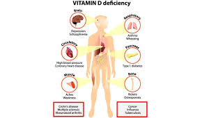 Vitamin D Deficiency Test Diagnosis Apollo Diagnostics