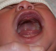 mouth newborn nursery stanford cine