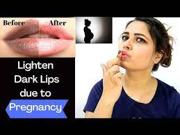 lighten dark lips hyperpigmentation