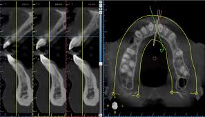 ct scan cbct charles d payet dds pa