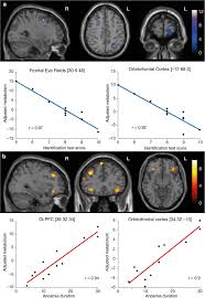 Benny bunt aurait dû réussir dans la vie grâce à sa formidable mémoire. Structural And Metabolic Brain Abnormalities In Covid 19 Patients With Sudden Loss Of Smell Springerlink