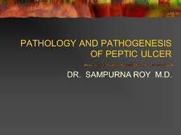 Pathology And Pathogenesis Of Peptic Ulcer Ppt Video