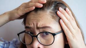 hair loss in women causes and