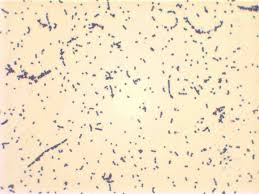 Listeria monocytogenes is a ubiquitous microorganism responsible for listeriosis, a rare but severe disease in humans, who can become infected by ingesting contaminated food products, namely dairy. 2