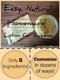 natural homemade lotion for eczema