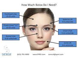 determine how much botox you will need