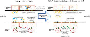 exclusive enteral nutrition in crohn s