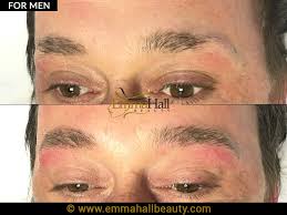 micropigmentation for men emma hall