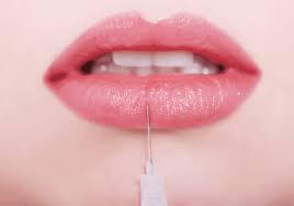 plump up your lips with fat injections