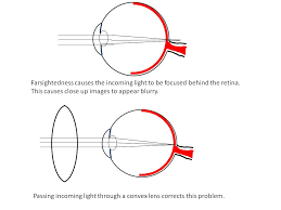 Eye See How Your Eyes Work And Why You Might Need Glasses