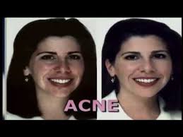 smart cover concealing creme commercial