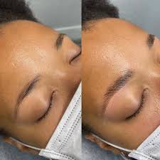 brow lamination what to know about the