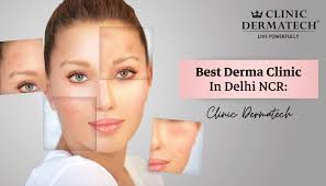 best derma clinic in delhi ncr clinic