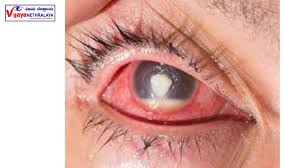 understanding corneal ulcers symptoms