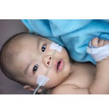 feeding a baby with bronchiolitis