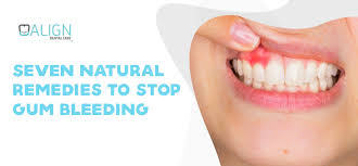 7 natural remes to stop gum bleeding