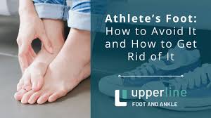 athlete s foot how to avoid it and how