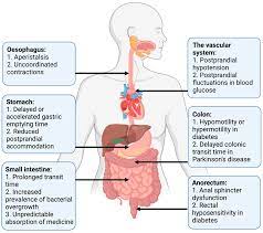 gastrointestinal autonomic dysfunction