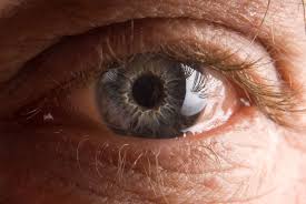 Keep your eye open while flushing with water. Conjunctivochalasis Eye Care In Sunnyside Ny
