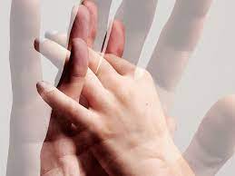 how does lupus affect a person s nails