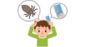 head lice get rid of it naturally