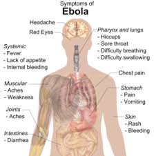 Ebola virus, formally called zaire ebolavirus, is a rare virus that infects humans and nonhuman the virus causes ebola virus disease (evd), a severe and sometimes fatal illness that can cause fever. Ebola Wikipedia