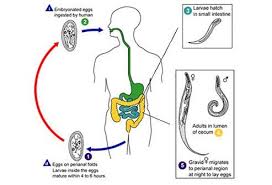 how to treat pinworm infection