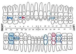 Dental Charting Diagram Quizlet