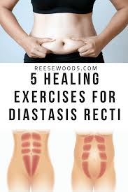 healing exercises for diastasis recti