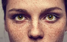 what all women with freckles need to